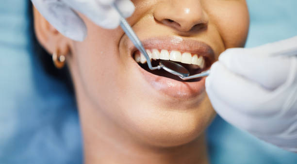 Best Emergency Treatment for Oral Infections in Desoto Lakes, FL